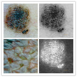 5Mピクセルの決断の皮の検査官のデジタル顕微鏡の皮の検光子の皮および頭皮のカメラ