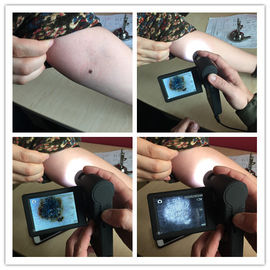 マイクロSDカードが付いているDermatoscopeの専門の電子ビデオ皮Inspecter