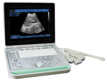 3D デジタル B/W の凸の線形 Transvaginal 調査が付いている携帯用超音波の走査器