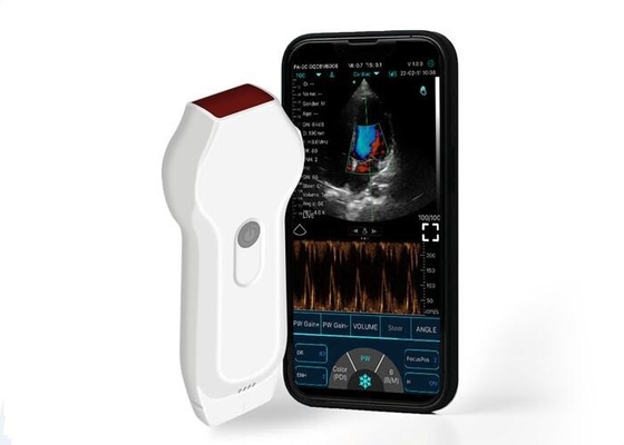 個人用超音波スキャナ Linear+Cardiac Probe 2.2MHz モバイル DICOM フォーマット