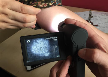 3インチTFT色の回転表示とのビデオ皮の顕微鏡携帯用Dermatoscope