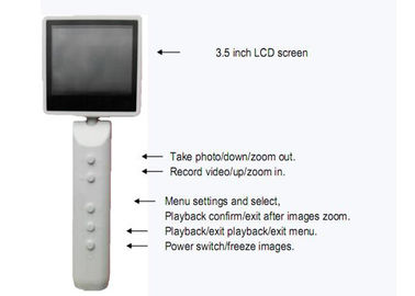 USBによって出力される任意WIFIの関係が付いている手持ち型のビデオ・カメラの診断ビデオ デジタルOtoscopeの検眼鏡