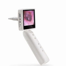 取り外し可能な充電電池によって点検するビデオOtoscopeの検眼鏡の耳