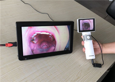 携帯用Otoscopeの検眼鏡の医院のためのSDのカード出力が付いているビデオ喉のカメラDermatoscope