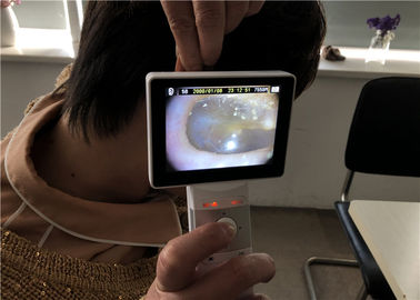 高リゾリューションを用いるデジタル ビデオOtoscopeのDermatoscopeの手持ち型の検眼鏡