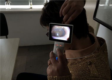 白色光のデジタル中立ビデオOtoscope Dermatoscopeおよび高リゾリューションを用いるOtoscopeのカメラ