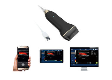 USBの超音波トランスデューサーの調査の手持ち型の超音波の走査器の無線電信の150g重量だけ