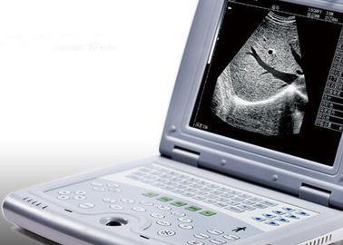 妊娠の携帯用超音波の走査器の2.2kgs重量だけのための携帯用超音波機械