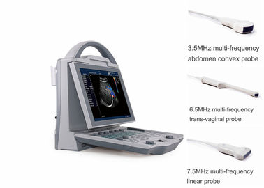 腹部の凸のTransvaginalトランスデューサーが付いている携帯用妊娠の超音波の走査器