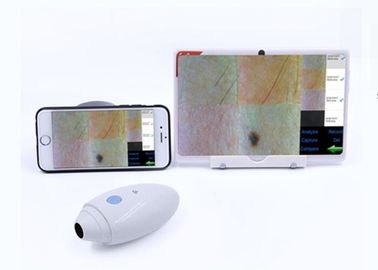 HDデジタルMobilophoneに接続されたビデオDermatoscopeの皮の毛の走査器の無線電信はIOS Andriodを支えました