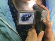 リチウム毛および皮の点検のための 3.7V/1050mAh 充電電池との TFT 3 インチの LCD ビデオ Dermatoscope