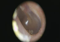 3.5&quot;フル カラーTFT-LCDデジタルのビデオENT検査の単位の耳の喉のNosalの皮の診断セット