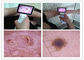 色TFT LCD USBのOtoscopeが付いている人体のデジタル ビデオOtoscopeの臨床ENT点検