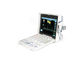 Full Digital Portable Color Ultrasound Scanner Economical Color Ultrasound Doppler With PW Function