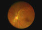 眼の光学機器の喉のカメラの2，000,000のピクセルが付いているビデオOtoscopeのDermatoscopeデジタルの内視鏡