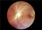 FOV 45°の自動焦点の医学のビデオ検眼鏡
