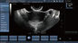 Transvaginal調査妊娠のための移動式色のドップラー超音波の走査器