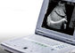 妊娠の携帯用超音波の走査器の2.2kgs重量だけのための携帯用超音波機械