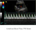 Ipadの500Gイメージの貯蔵を用いる超音波診断装置携帯用超音波の走査器