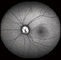 FOV 15°、30°の60°イメージのサイズ1024*1024の共焦点の網膜のOpthalmoscopeデジタルのFundusのカメラ