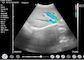 ドップラー超音波の携帯用診断手持ち型のドップラー家の超音波のObstetric Gynecologyの小児科の適用