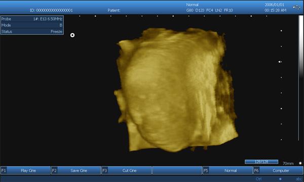 3DデジタルのラップトップB/Wの凸の線形Transvaginal調査が付いている携帯用超音波の走査器