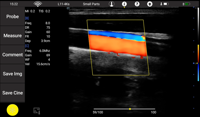 取り外し可能なTransvaginal超音波の調査の無線超音波の調査の凸の線形心臓調査