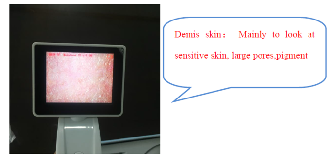 医者のためのセリウムBS5SHデジタルの皮の検光子のデジタル皮の湿気のメートル