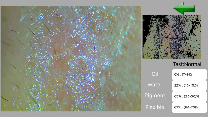 紫外線の高リゾリューションを用いる小型デジタル皮の検光子の皮および頭皮の分析装置