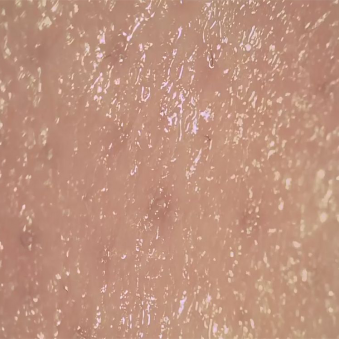 皮の湿気の探知器の皮のDermの気孔の表面を観察する無線デジタル皮の検光子