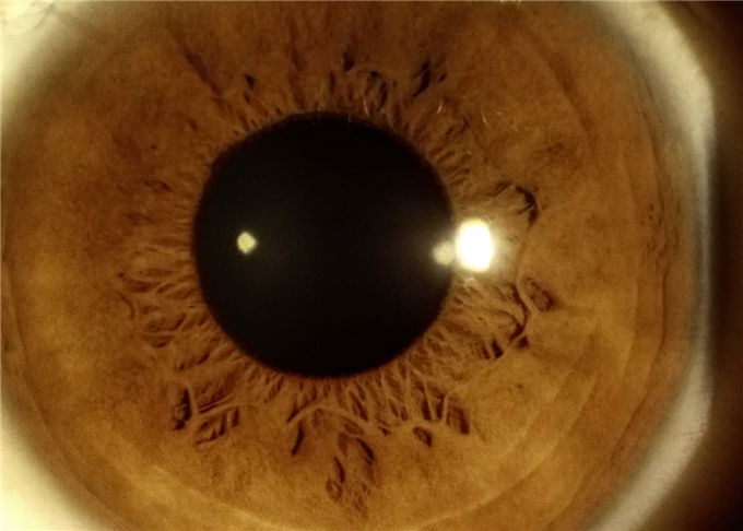デジタル前方の区分イメージ投射10X拡大16MPの決断に使用する手持ち型の切り開かれたランプの眼科学装置