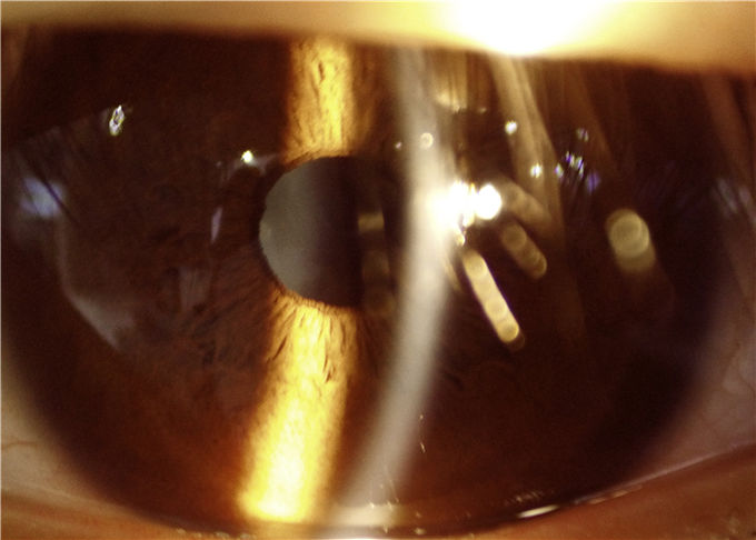 デジタル前方の区分イメージ投射10X拡大16MPの決断に使用する手持ち型の切り開かれたランプの眼科学装置