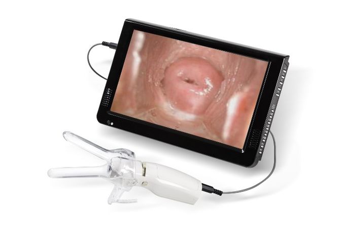 高い定義女性の自己診断の内視鏡AV （ビデオ）信号のデジタル電子Colposcope 3