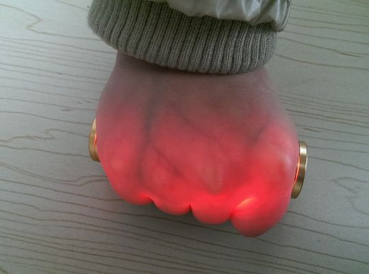 携帯用管プロジェクターVenipunctureの赤外線静脈のファインダーの静脈のロケータの金アルミニウム