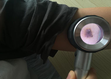 皮の点検のためのヘルスケアの手持ち型の医学のDermatoscopeカスタマイズされたデジタルのビデオOtoscope