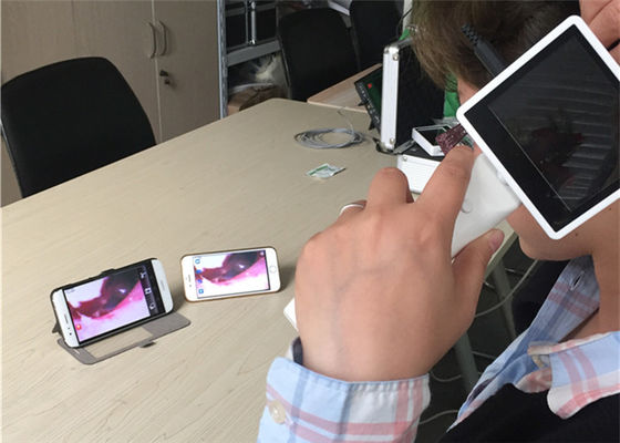 720X480デジタルビデオ耳鏡