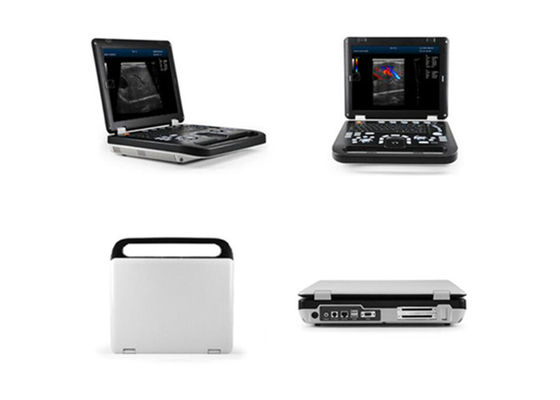 15インチLED 2つの調査の関係が付いている診断人間色のドップラー機械超音波の走査器