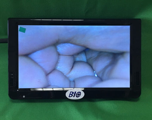 ポータブル デジタル 電子 コルポスコップ