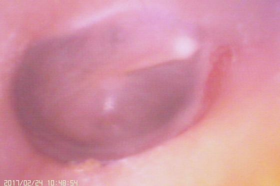 720X480デジタルビデオ耳鏡