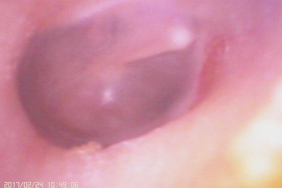 720X480デジタルビデオ耳鏡