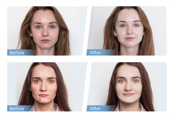 最新の4極EMS自動血清アプリケーターハイドラペンH5フェイススキンダーママイクロニードリングペンエッセンスコラーゲン再生