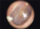 使い捨て可能なイヤーマフの耳の目の喉のための利用できる医学の携帯用Otoscopeの内視鏡