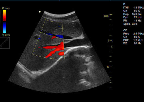 15インチの完全なデジタル色のドップラー機械2 USBポートとの携帯用ドップラー イメージ投射超音波
