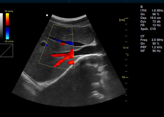 15インチの完全なデジタル色のドップラー機械2 USBポートとの携帯用ドップラー イメージ投射超音波