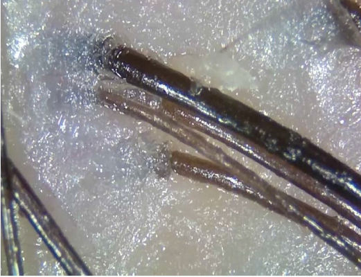 携帯用無線デジタル皮の検光子の遠隔医療の診断装置はとのライトを分極します