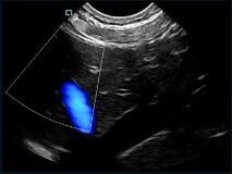 ミニ ポケット ハンドヘルド 超音波スキャナー