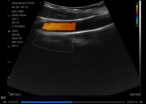 デジタルワイヤレスハンドヘルド超音波スキャナー