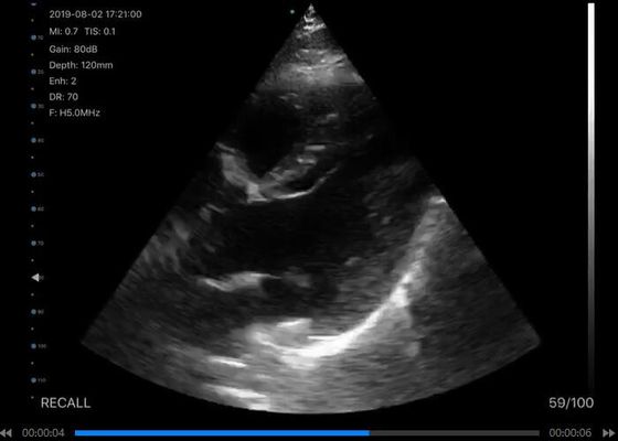デジタルワイヤレスハンドヘルド超音波スキャナー