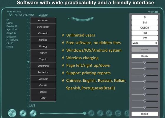デジタルワイヤレスハンドヘルド超音波スキャナー