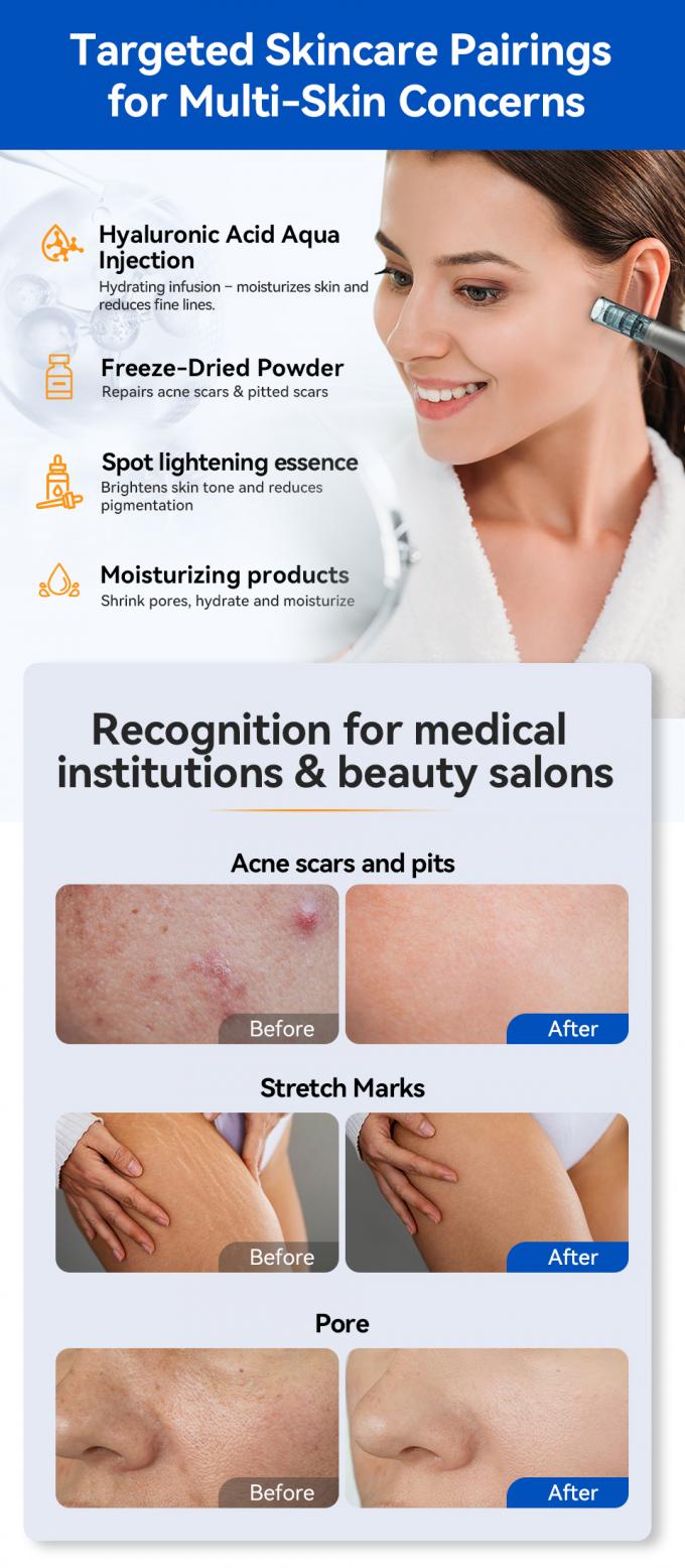 MTS Hydra Pen H5 Microneedle Derma Pen 人気 アンチエイジング 皮膚ケア デバイス 顔 肌の若返り 白化 コラーゲン療法 7